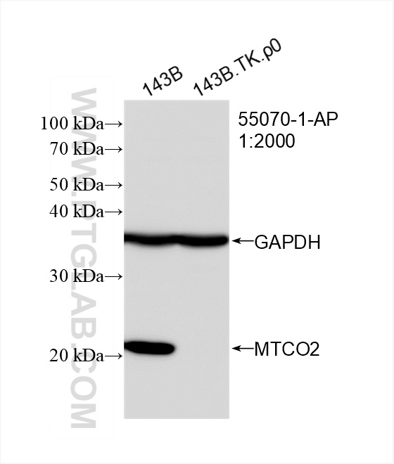 WB analysis of 143B.TK.P0 using 55070-1-AP