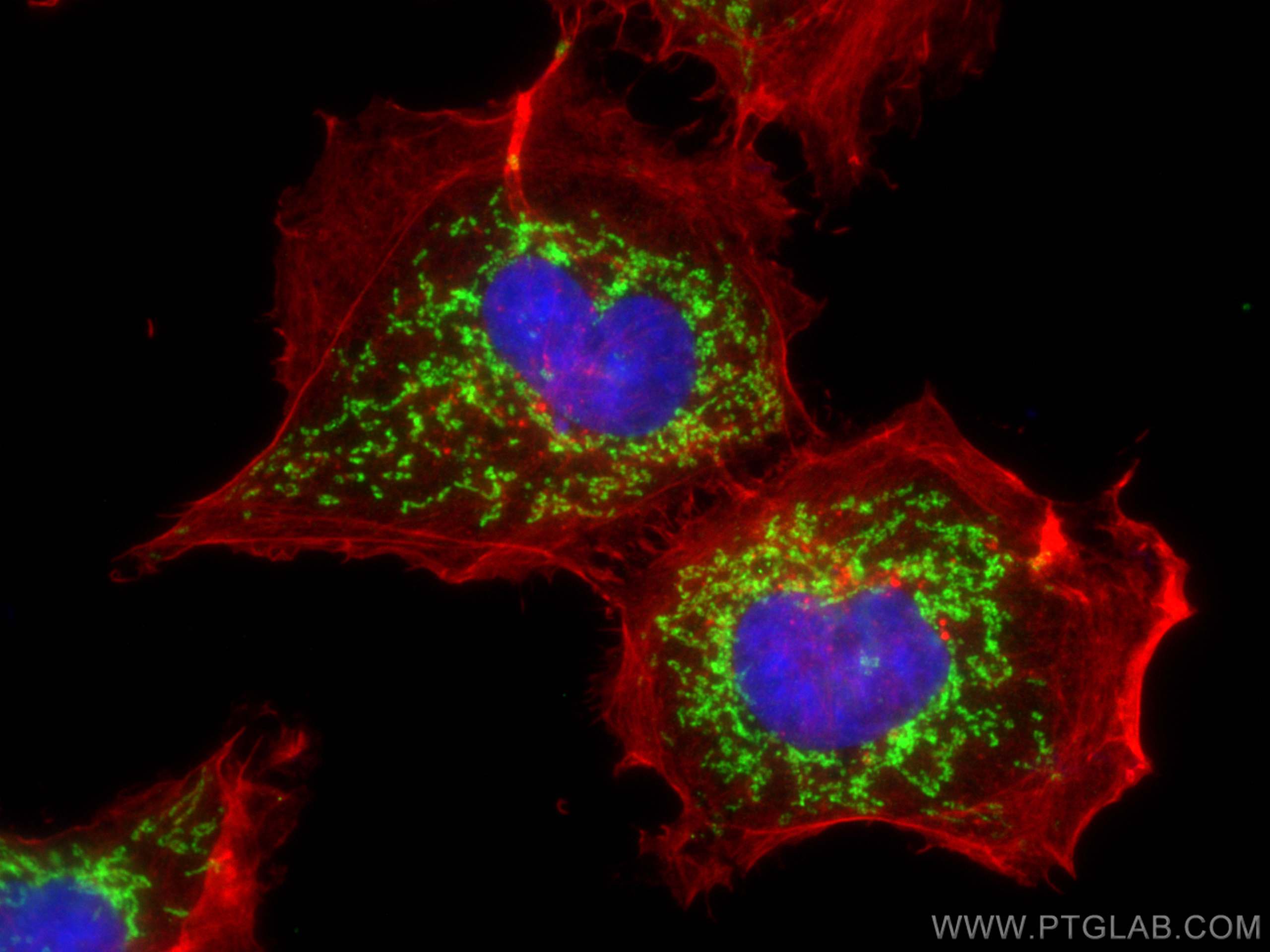 IF Staining of A431 using 11425-1-AP