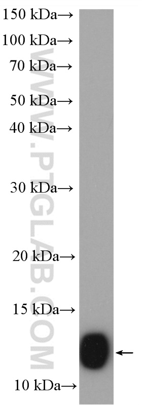 WB analysis of Caco-2 using 11425-1-AP