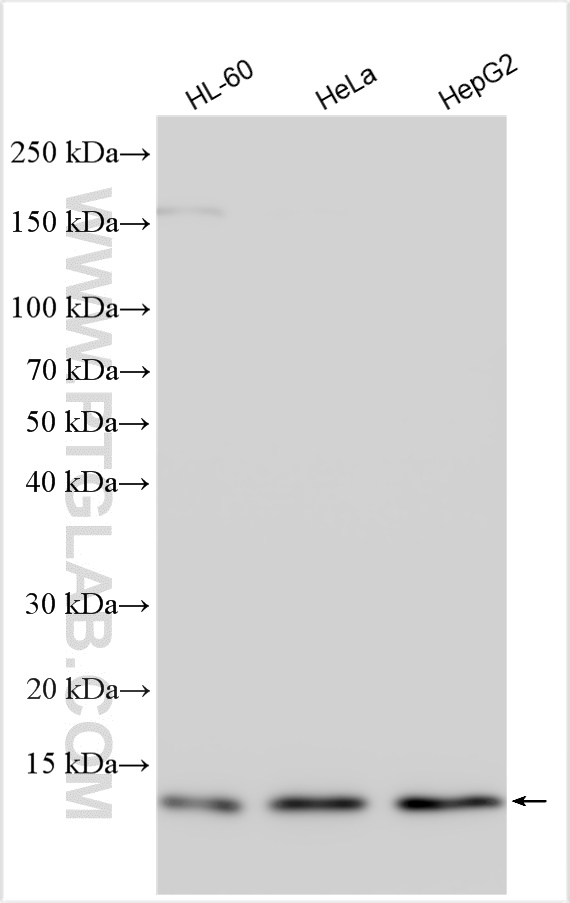 WB analysis using 11425-1-AP