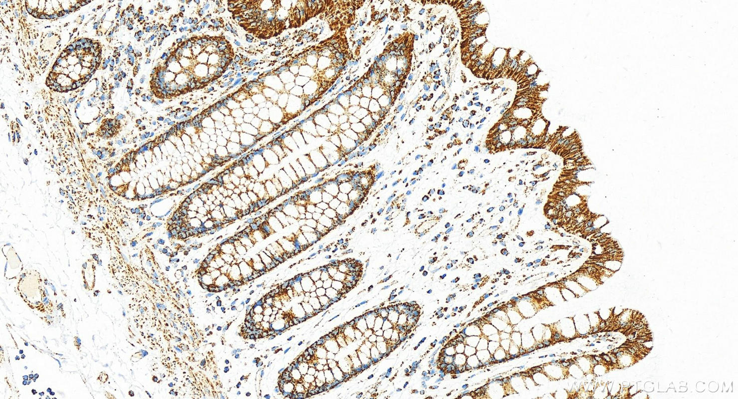 IHC staining of human colon using 82916-1-RR