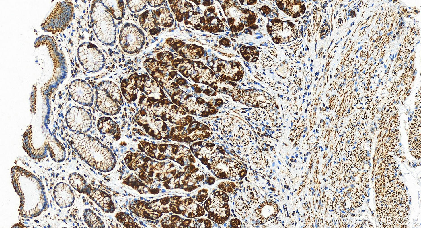 IHC staining of human stomach using 82916-1-RR