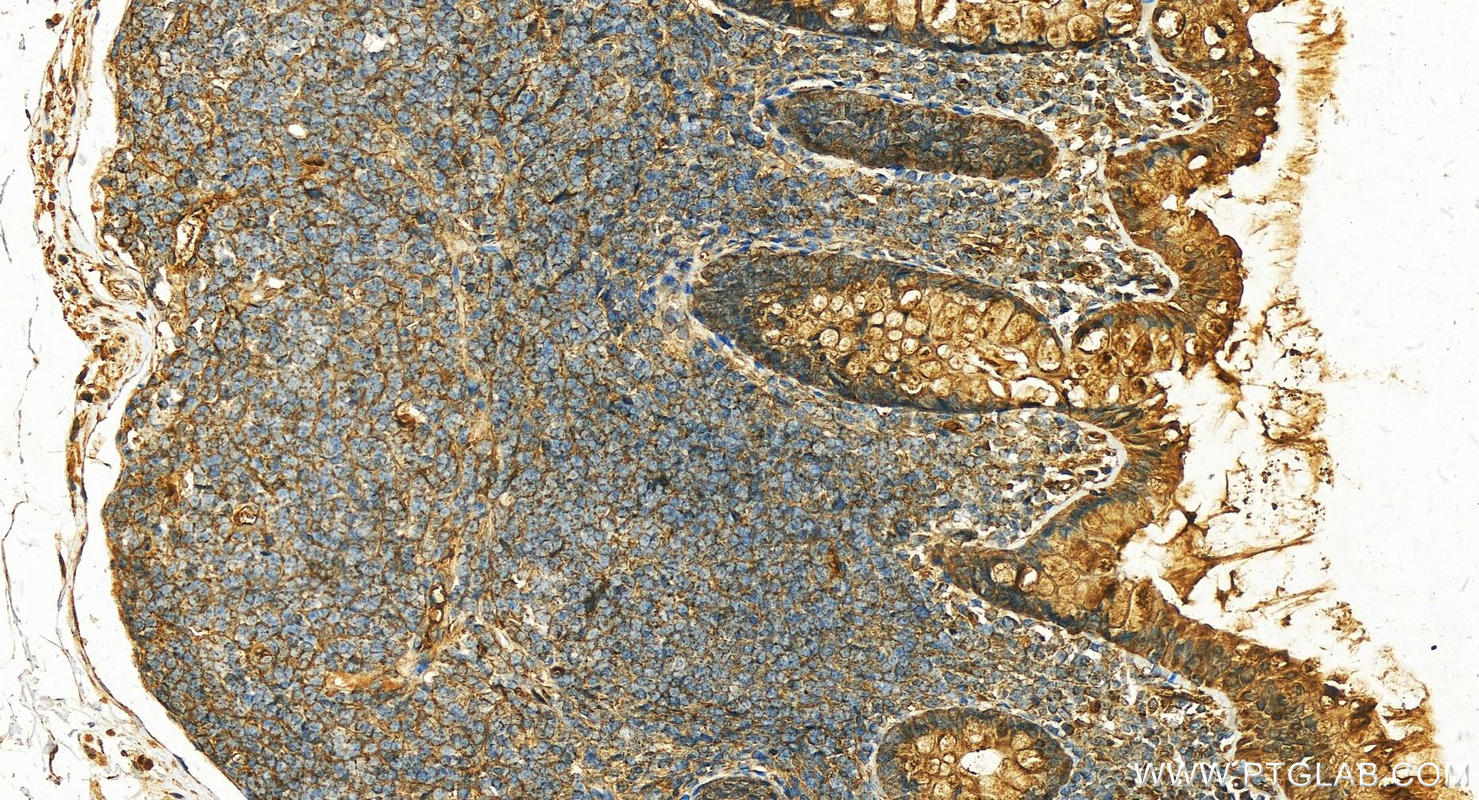 IHC staining of human normal colon using 21131-1-AP