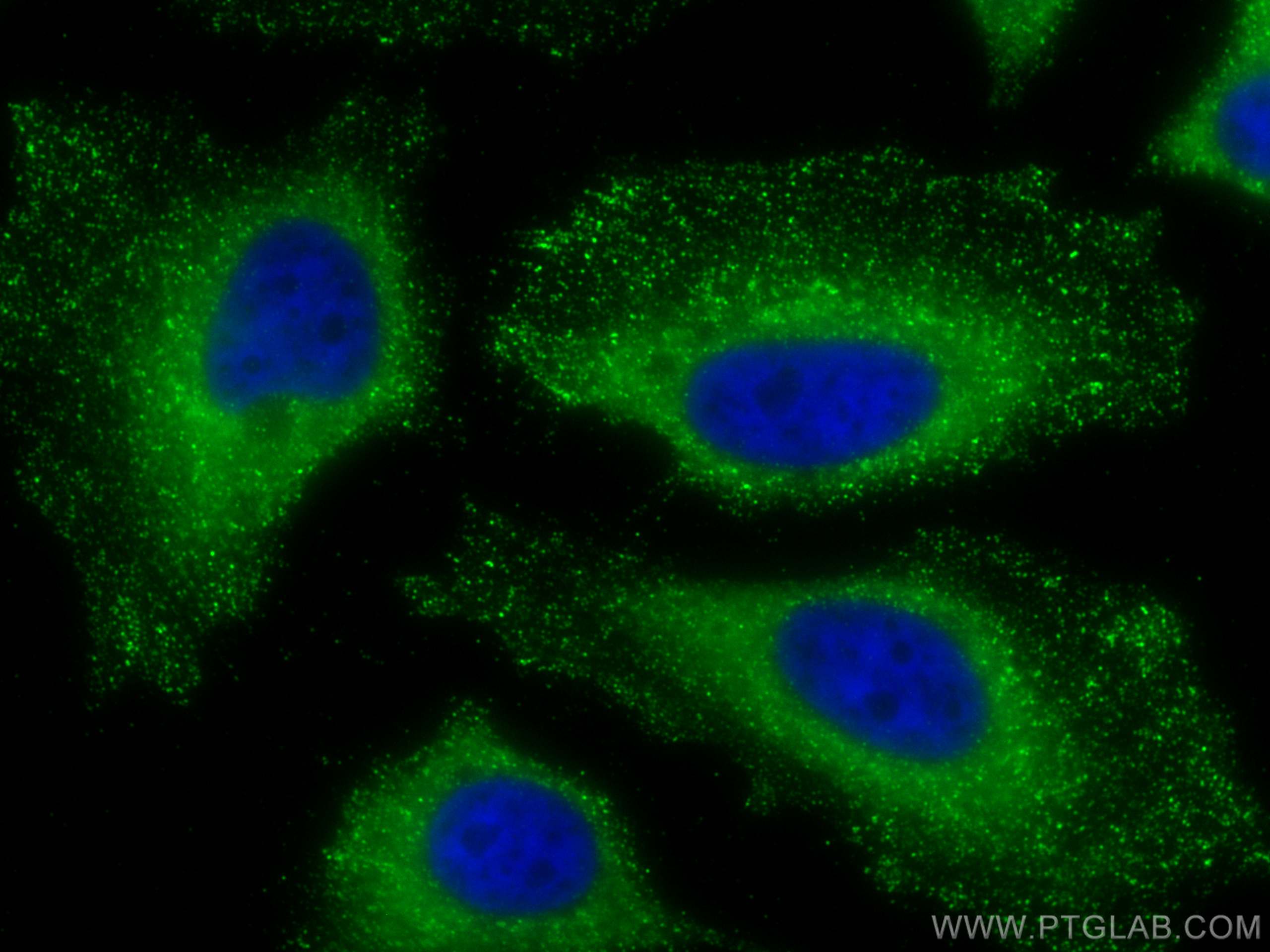 IF Staining of HeLa using 66156-1-Ig