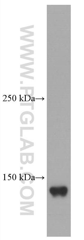 WB analysis of rat liver using 66156-1-Ig