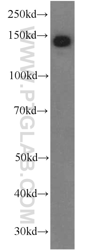 WB analysis of human placenta using 66156-1-Ig