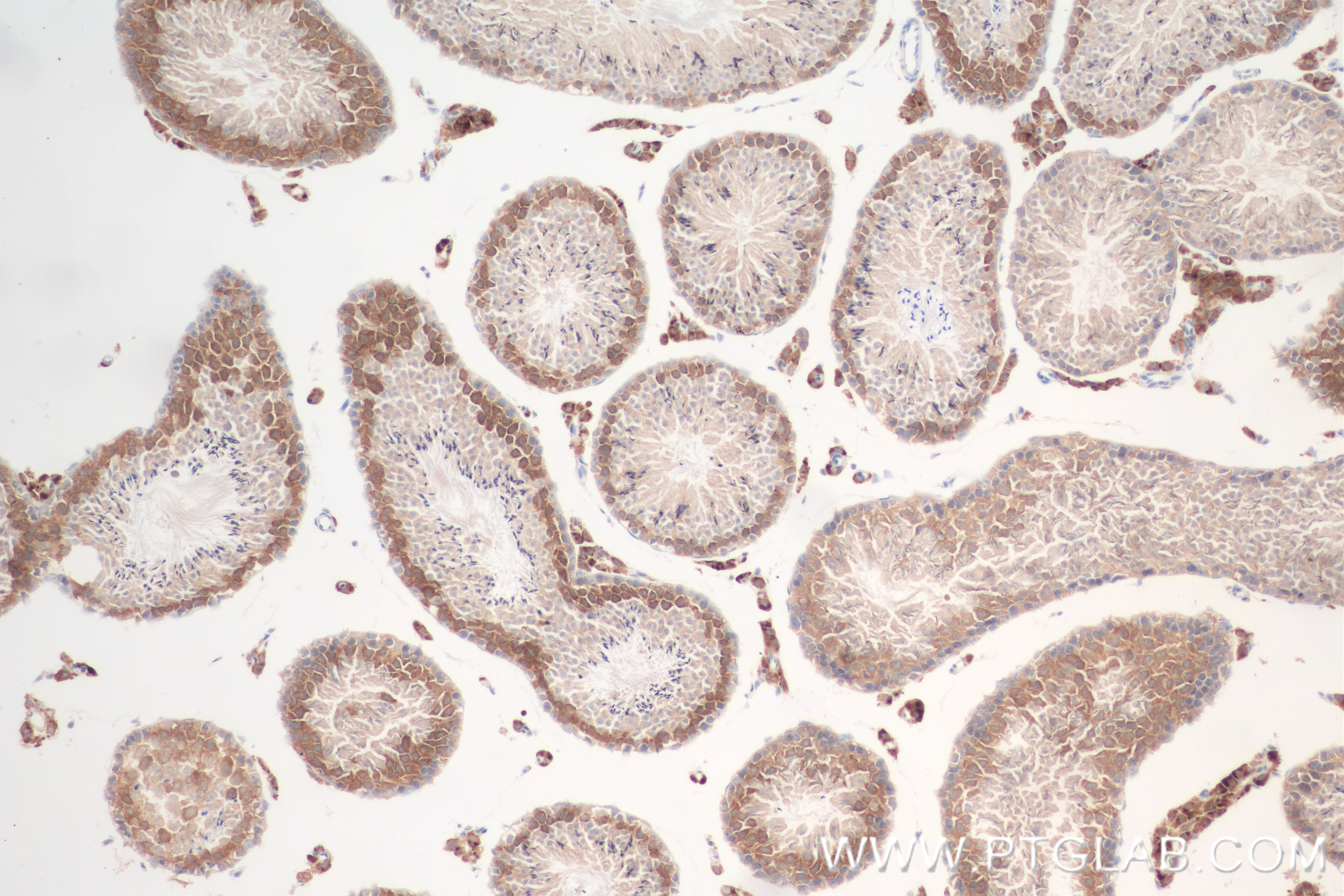 IHC staining of mouse testis using 80965-5-RR (same clone as 80965-5-PBS)