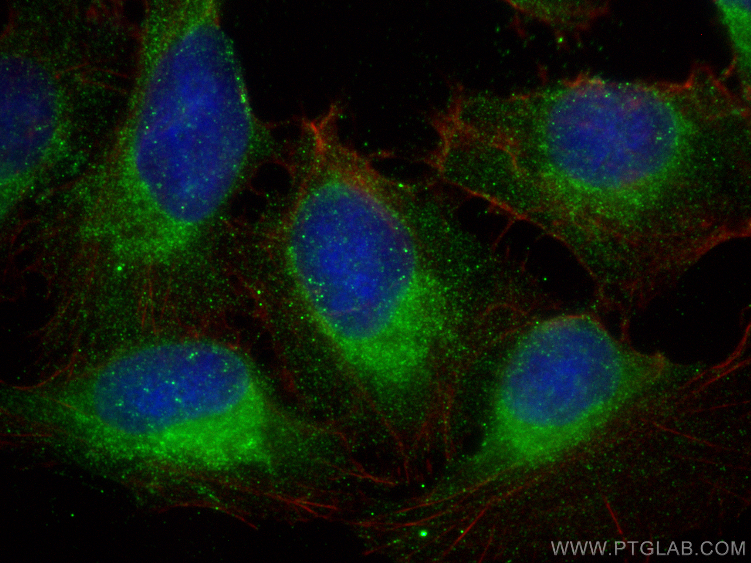 IF Staining of U2OS using 15836-1-AP