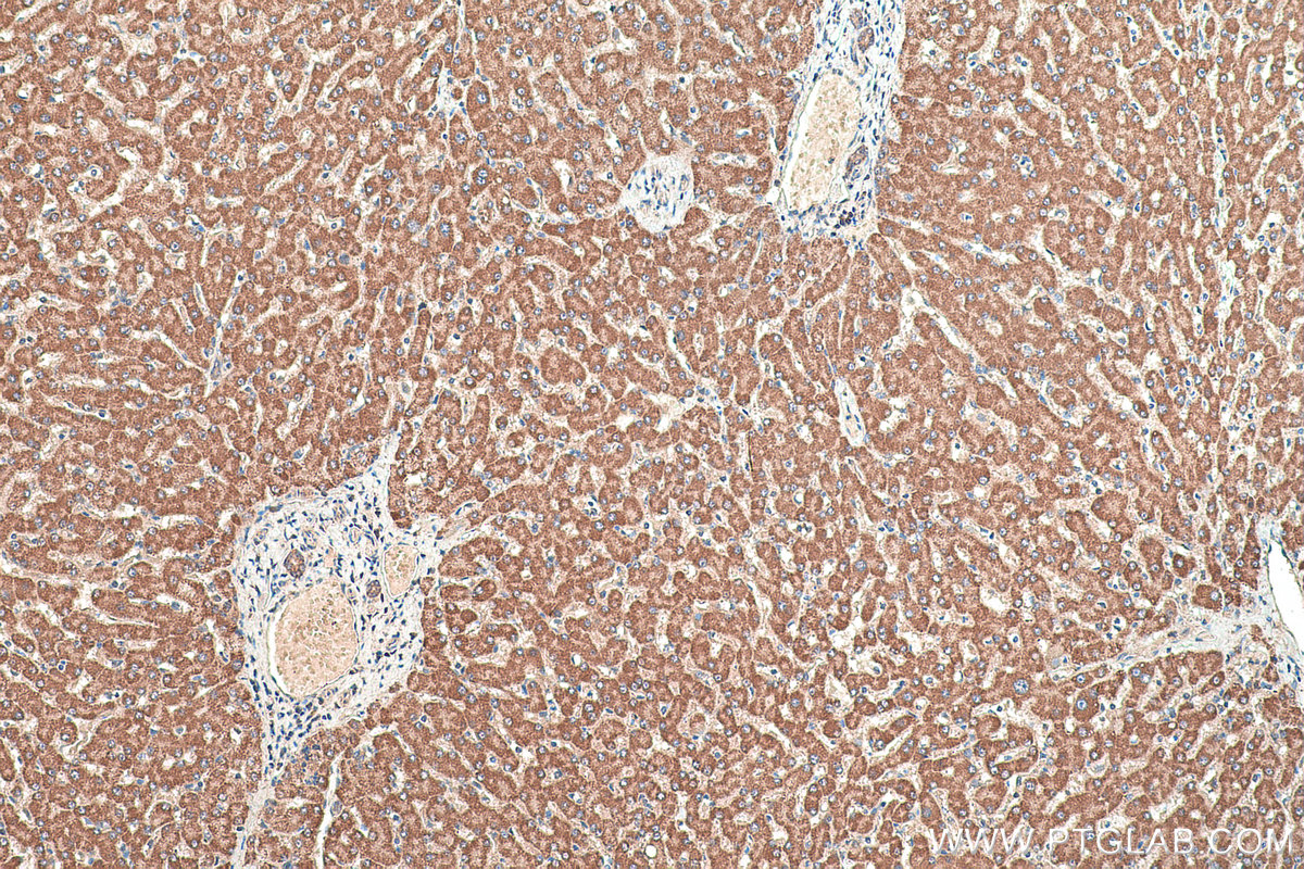 IHC staining of human liver using 10672-1-AP