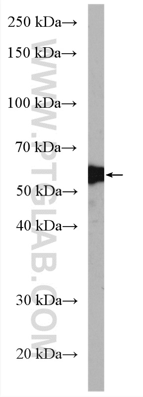 WB analysis of mouse liver using 10672-1-AP