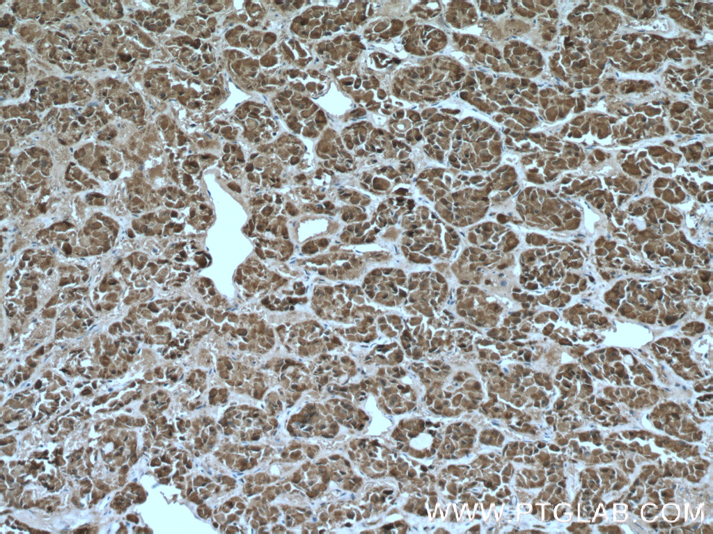 IHC staining of human pituitary using 13710-1-AP