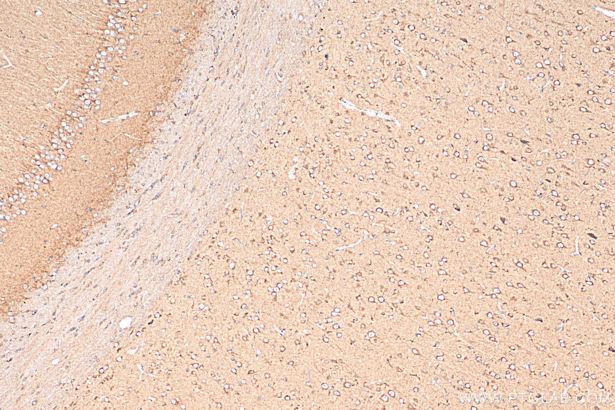 IHC staining of rat brain using 13710-1-AP