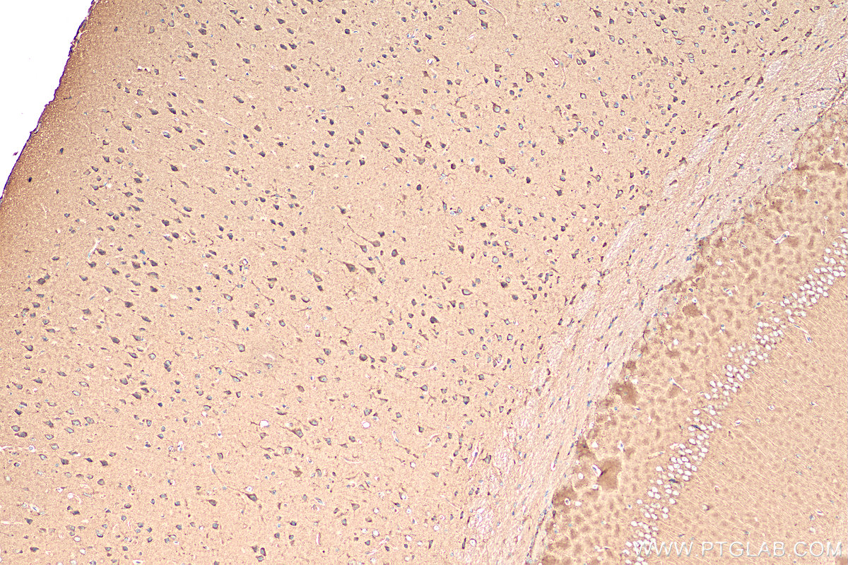 IHC staining of mouse brain using 13710-1-AP