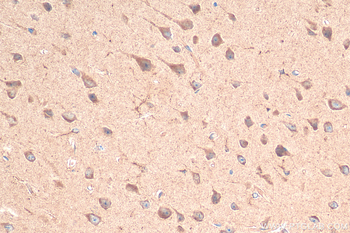 IHC staining of mouse brain using 13710-1-AP