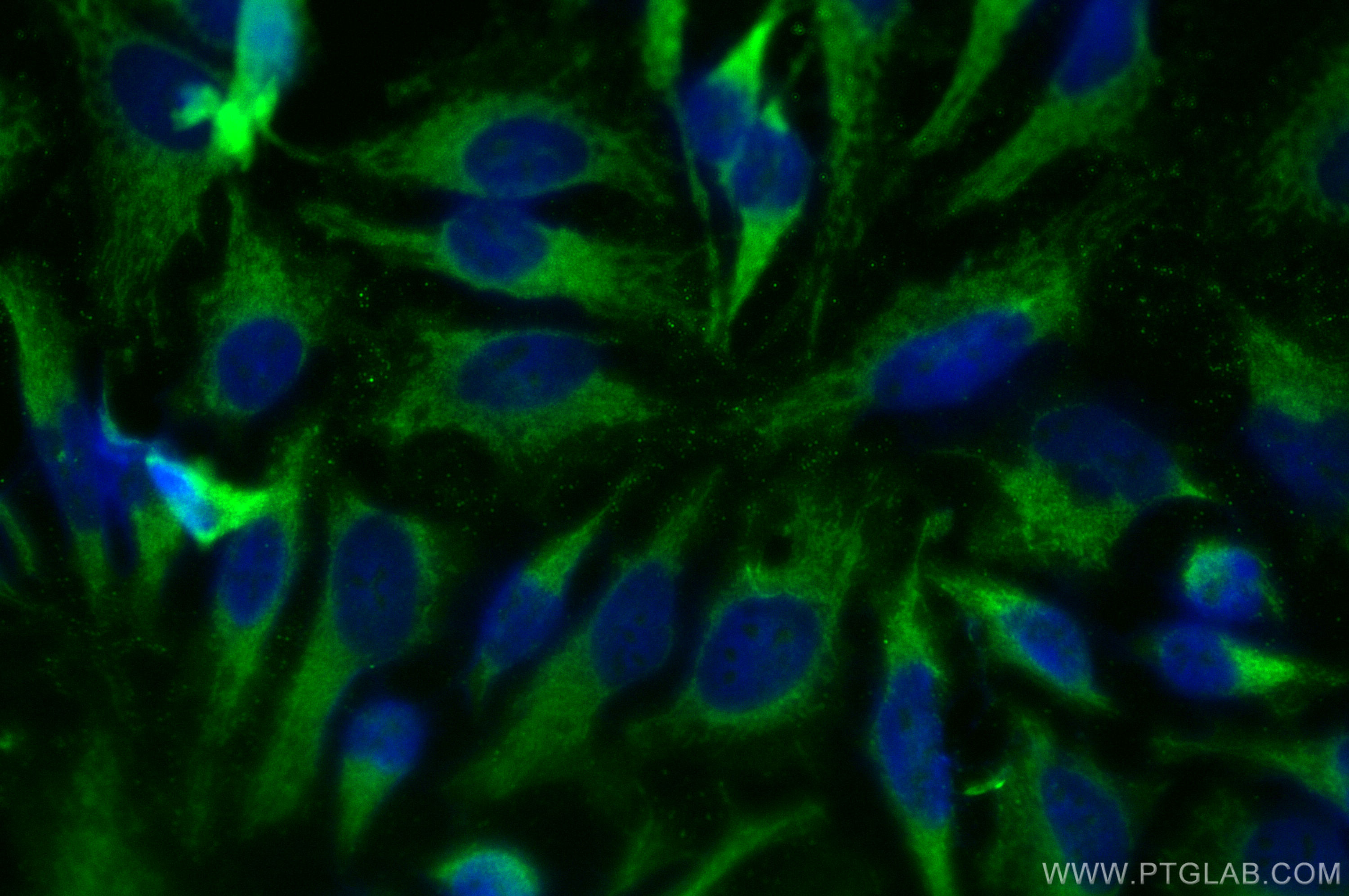 IF Staining of HeLa using 13274-1-AP