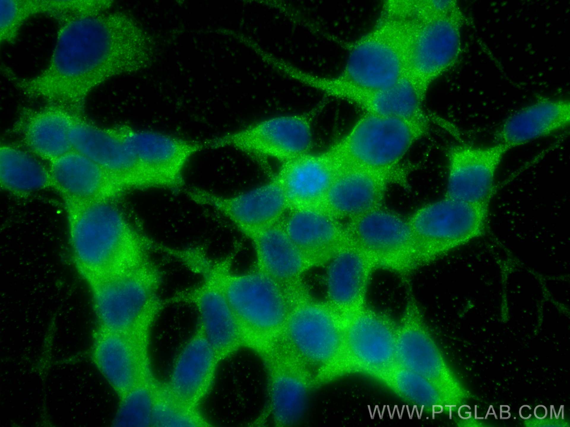 IF Staining of SH-SY5Y using 25342-1-AP