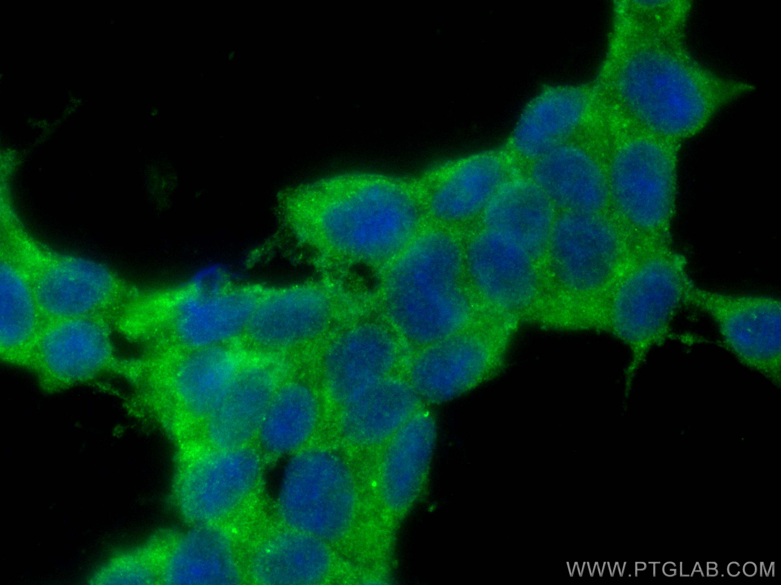 IF Staining of SH-SY5Y using CL488-10246