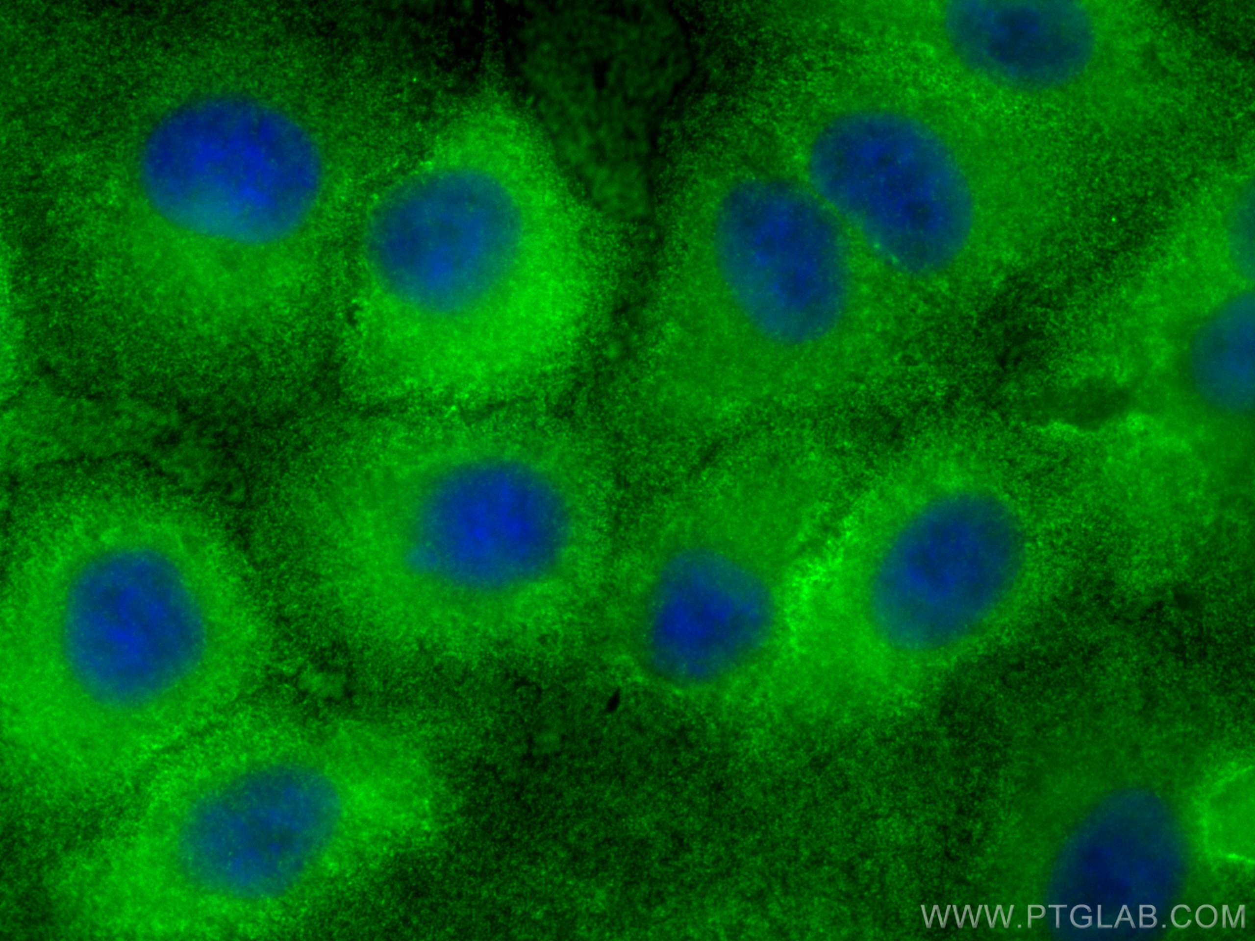 IF Staining of A549 using 18149-1-AP