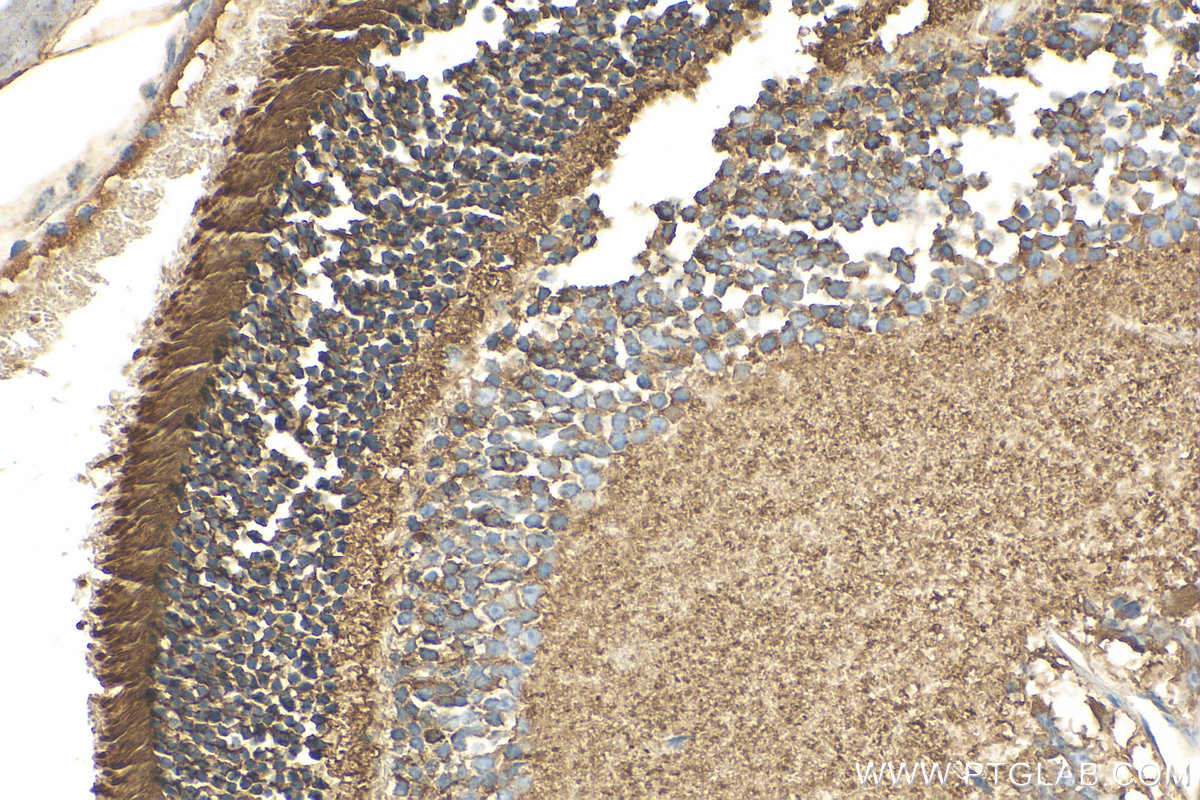 IHC staining of mouse eye using 21222-1-AP