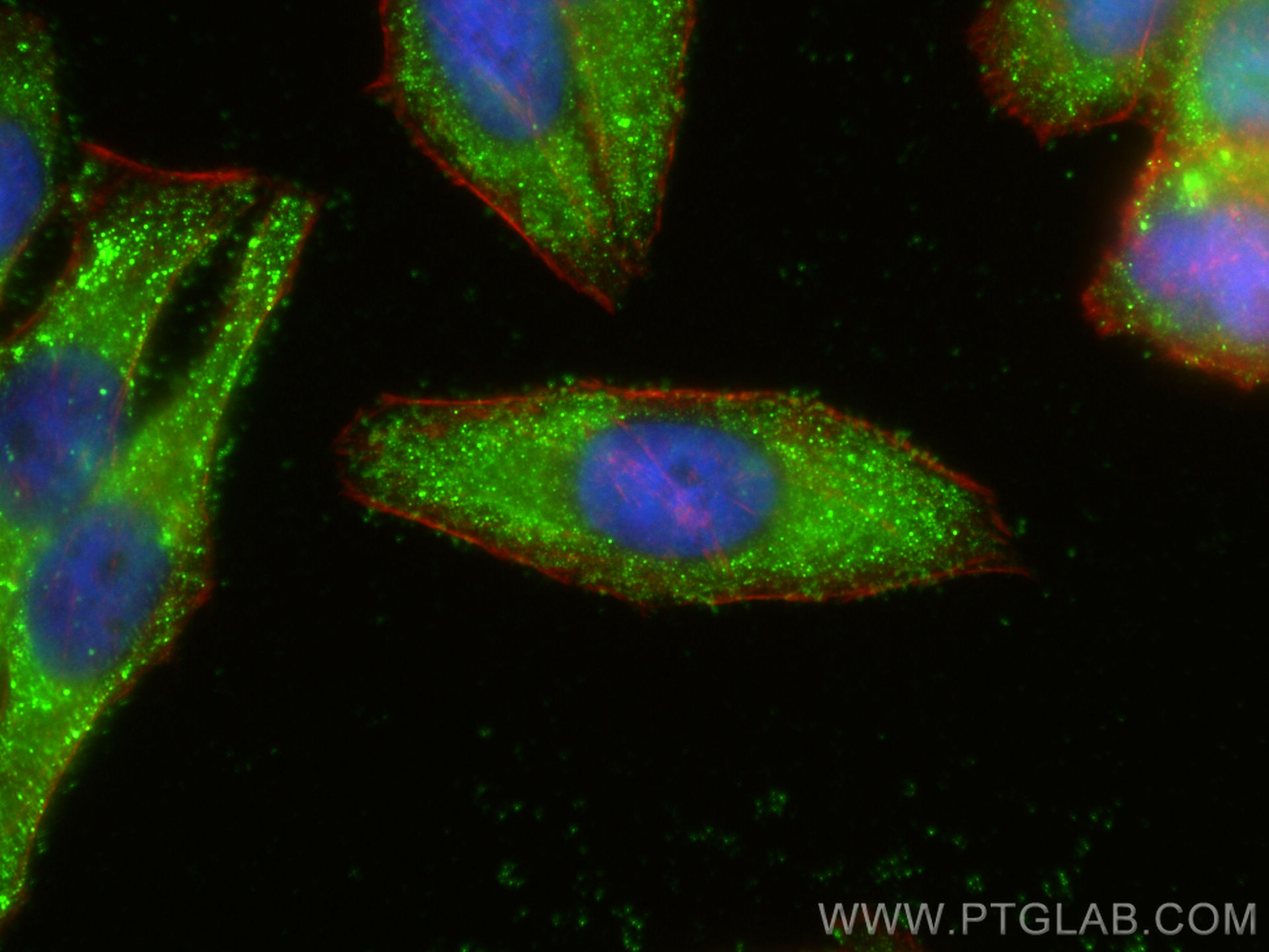 IF Staining of HepG2 using 13385-1-AP