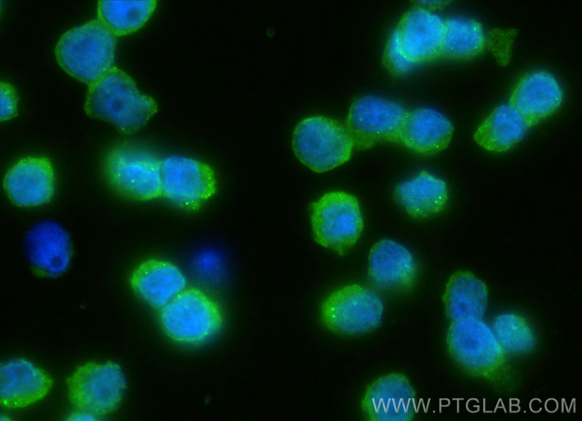 IF Staining of COLO 320 using 13385-1-AP