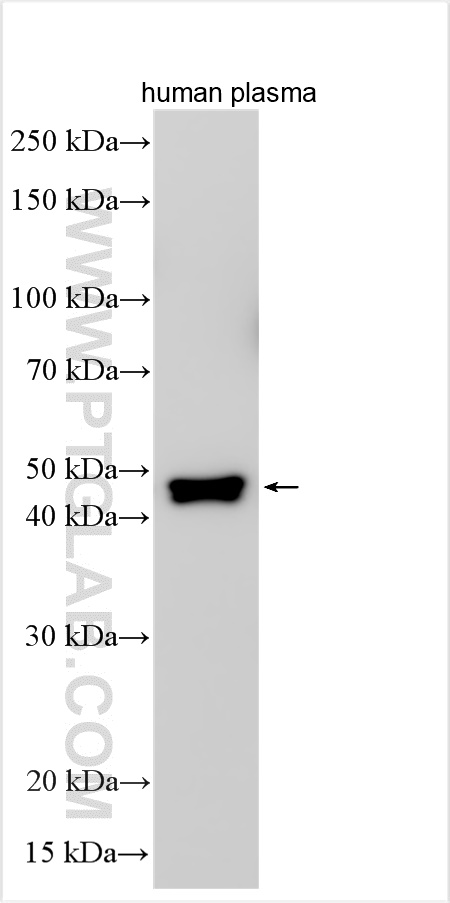 CPN1