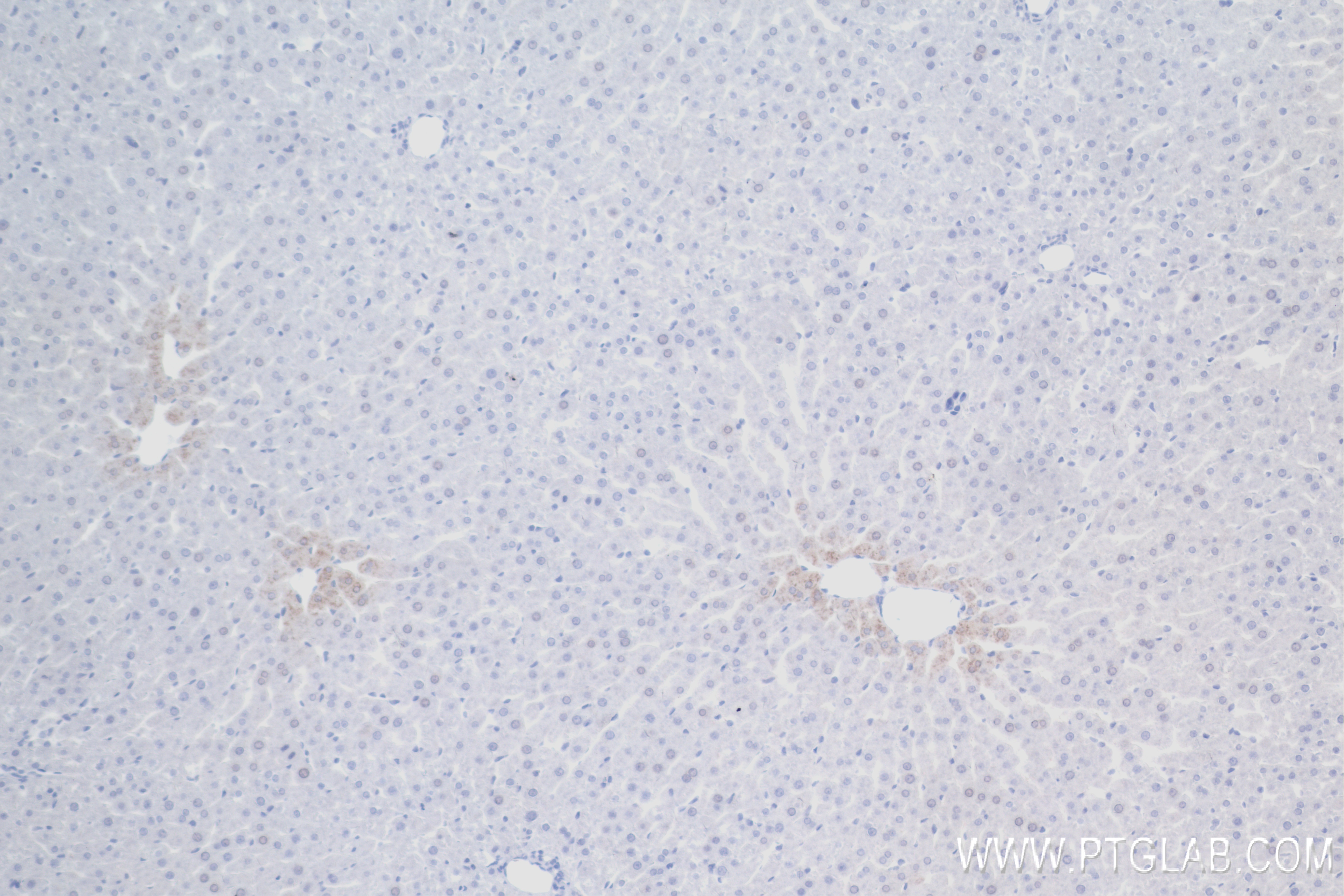 IHC staining of rat liver using 84218-1-RR