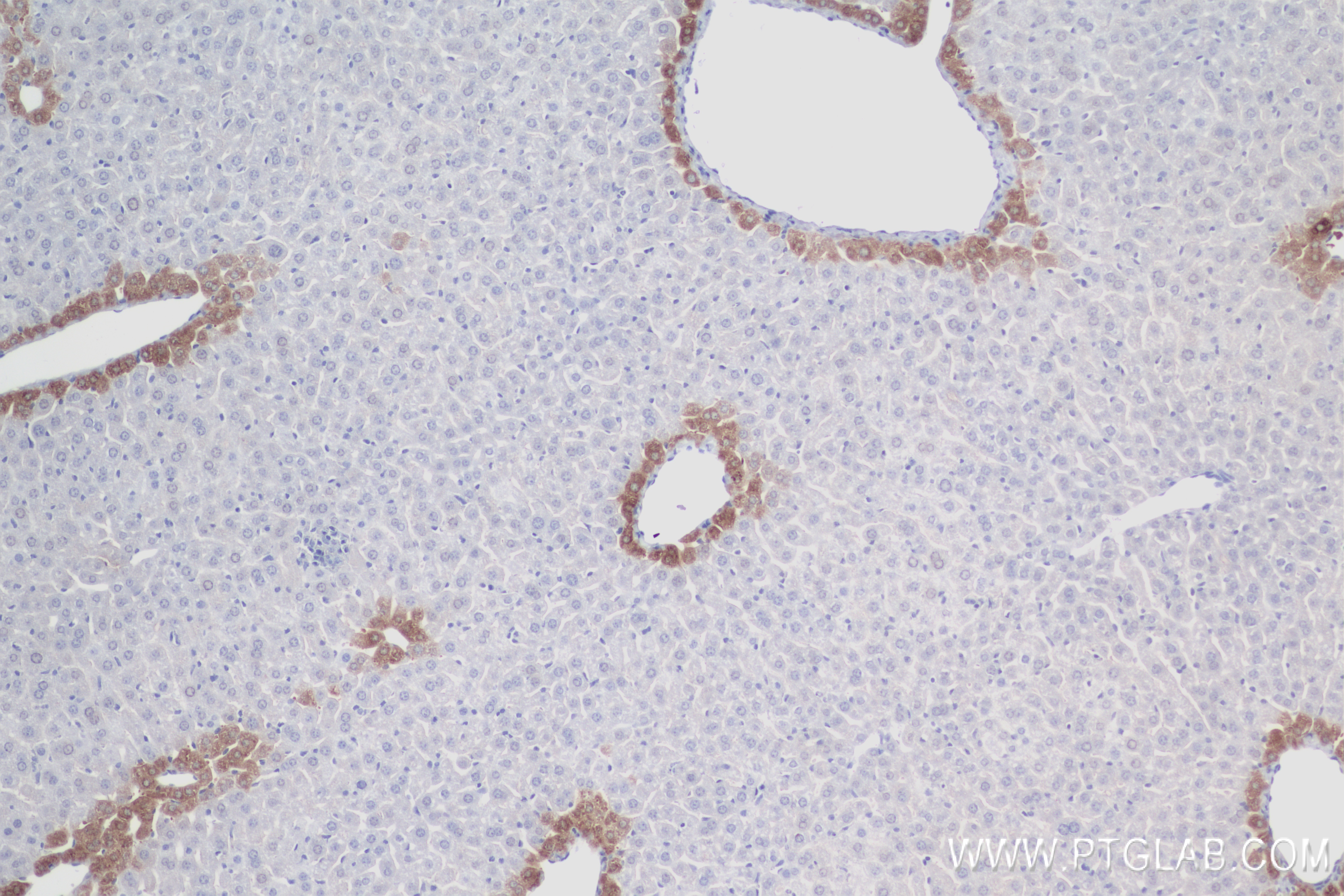 IHC staining of mouse liver using 84218-1-RR