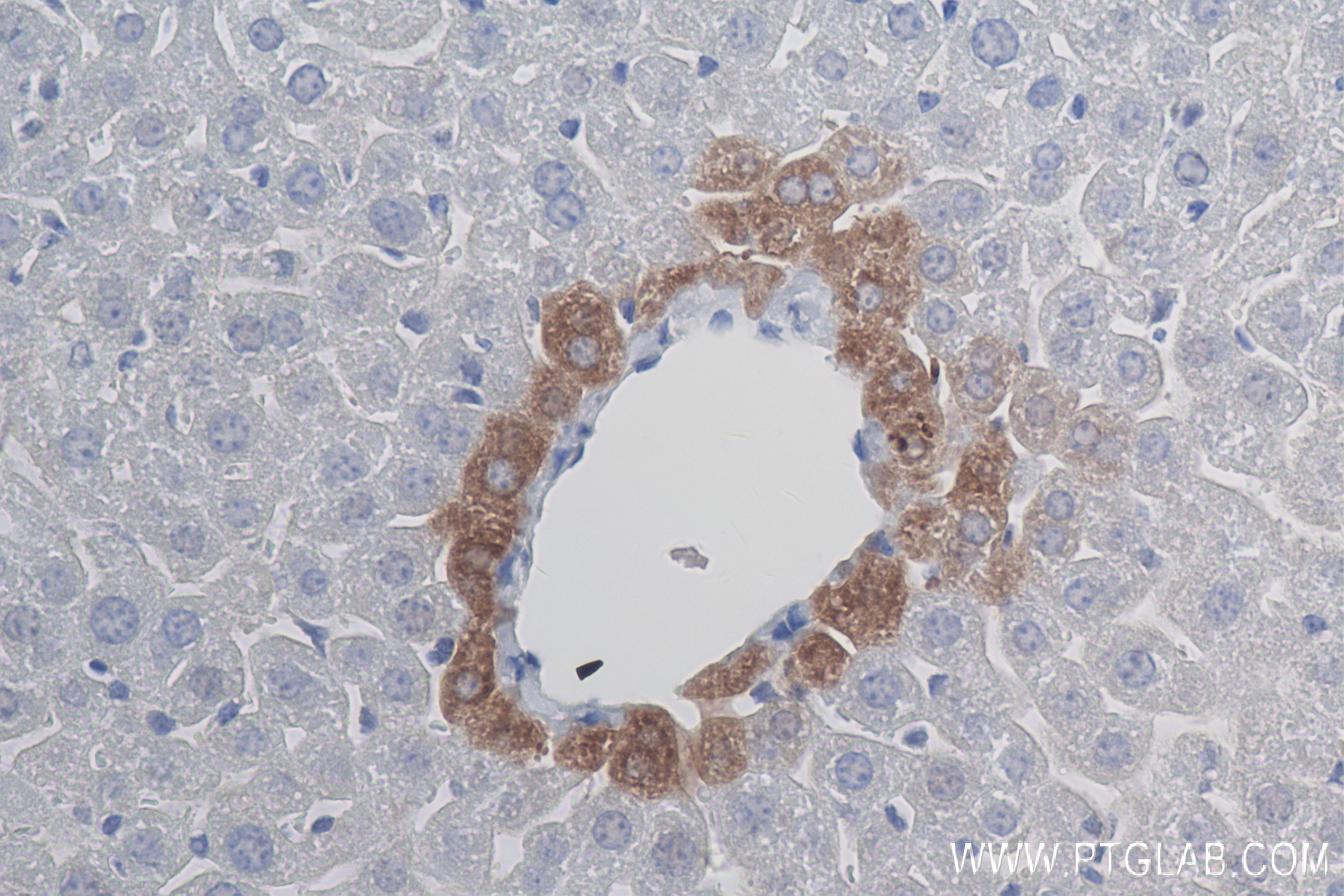 IHC staining of mouse liver using 84218-1-RR