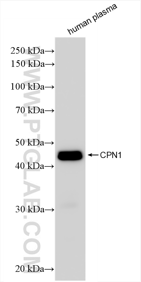 CPN1