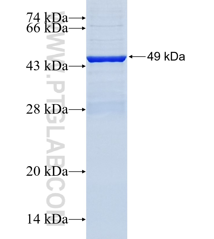 CPN1 fusion protein Ag34806 SDS-PAGE