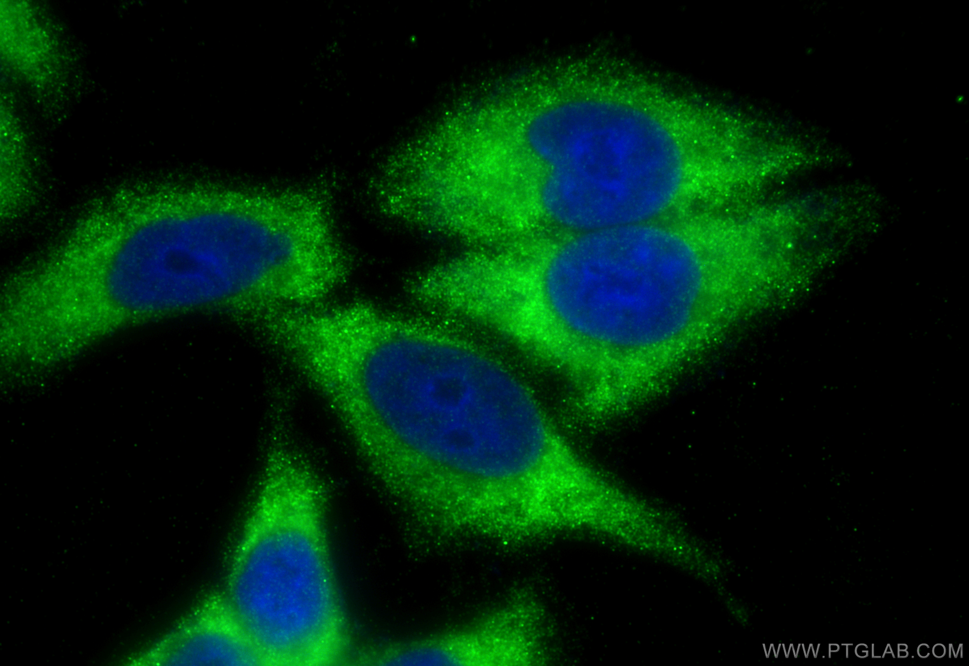 IF Staining of HepG2 using 11186-1-AP