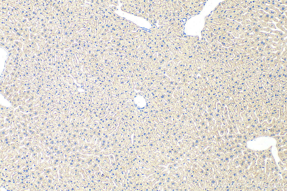 IHC staining of mouse liver using 11186-1-AP