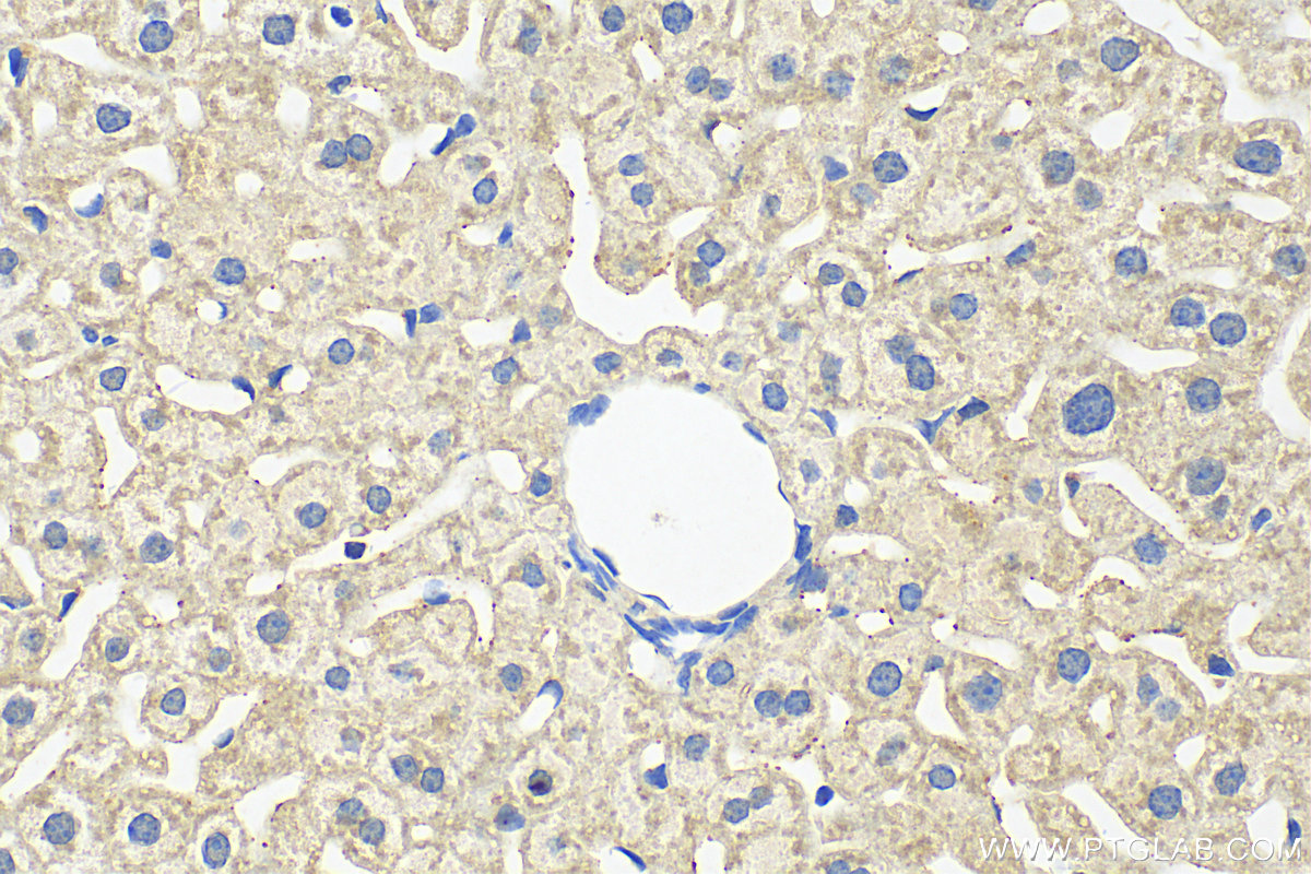 IHC staining of mouse liver using 11186-1-AP