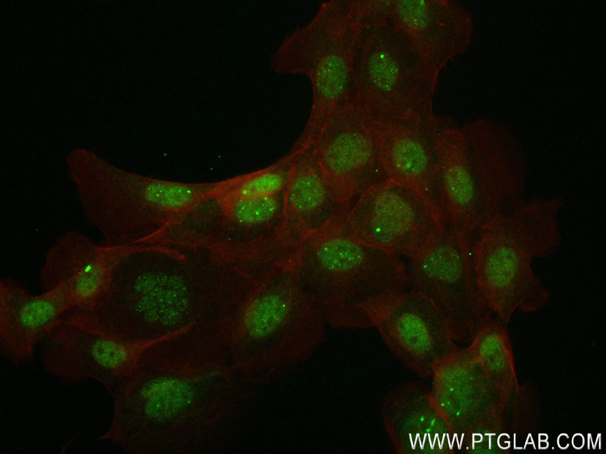 IF Staining of A431 using 83820-5-RR (same clone as 83820-5-PBS)