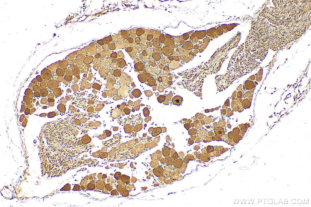 IHC staining of rat dorsal root ganglion using 13782-1-AP