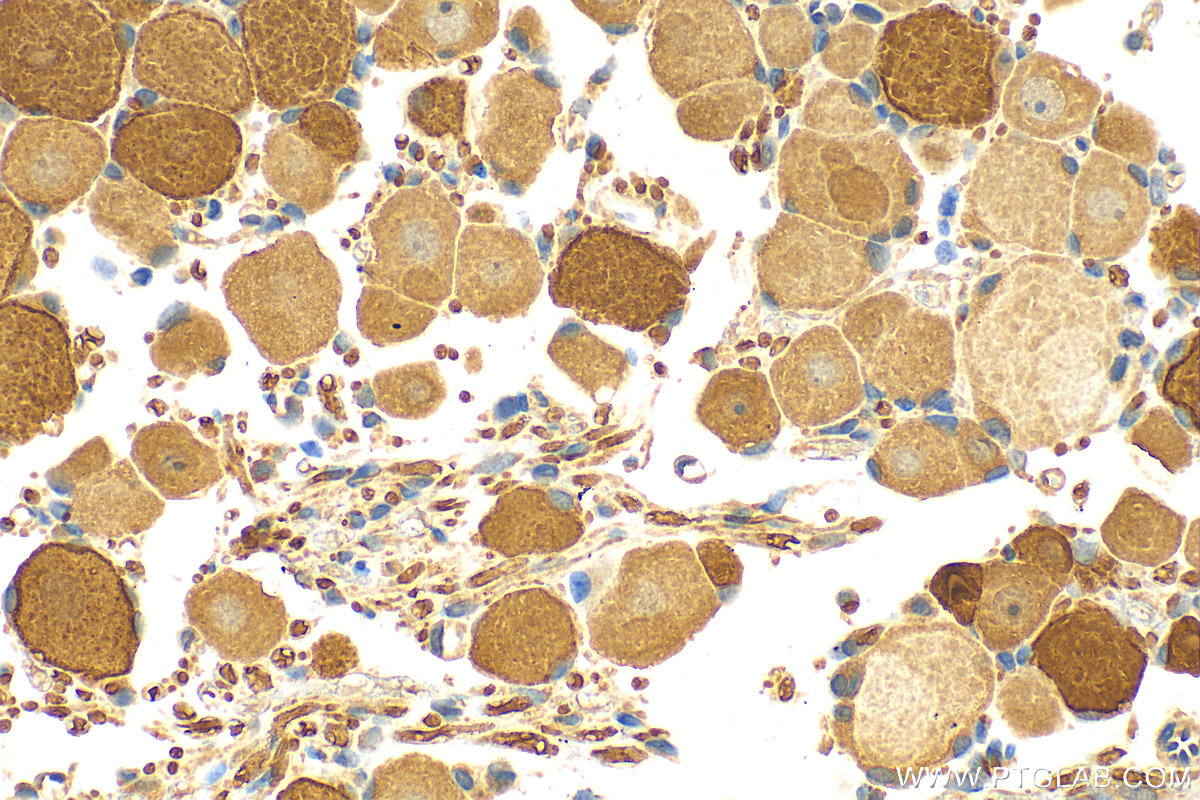 IHC staining of rat dorsal root ganglion using 13782-1-AP