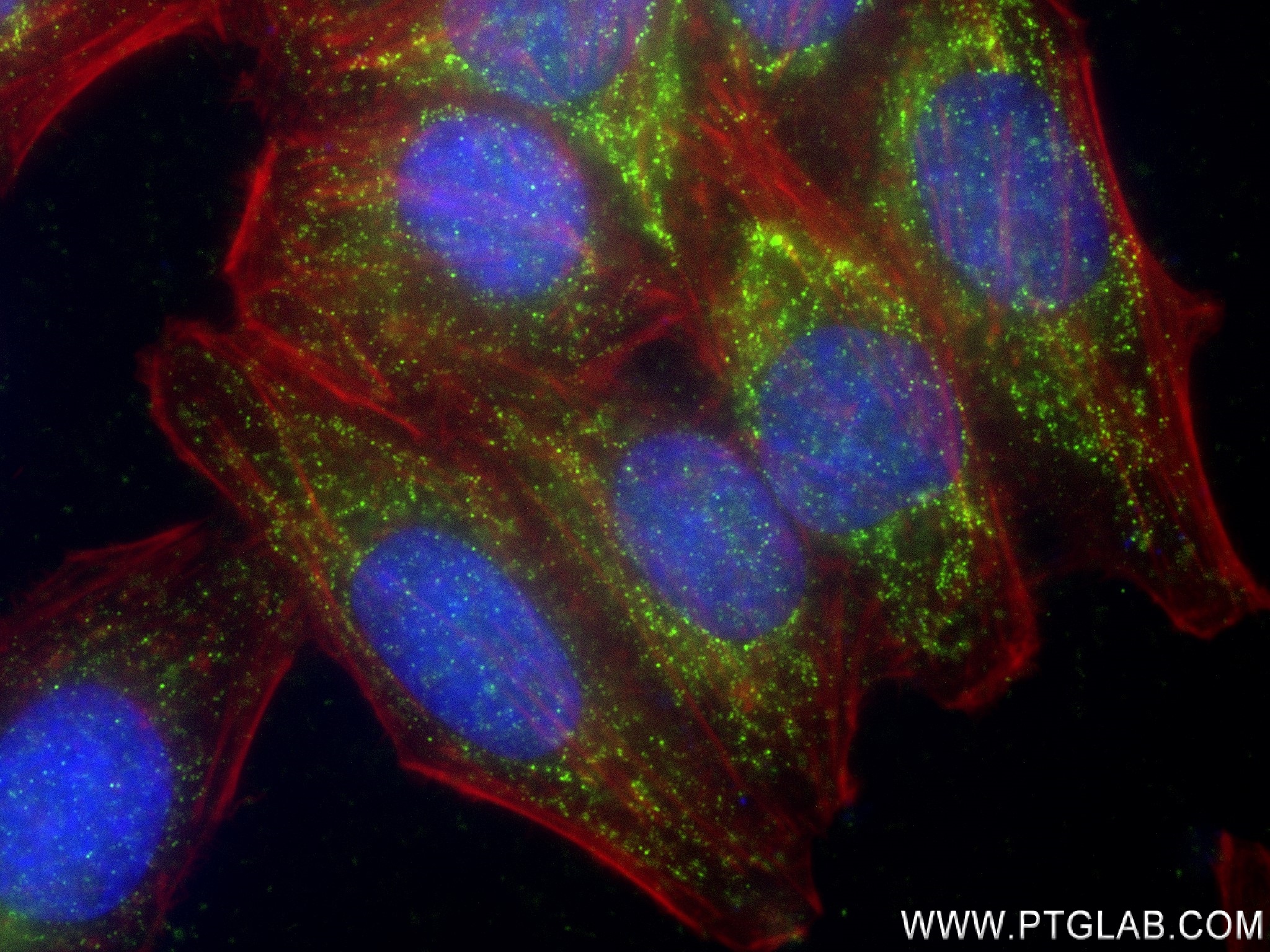 IF Staining of HepG2 using 84277-1-RR (same clone as 84277-1-PBS)