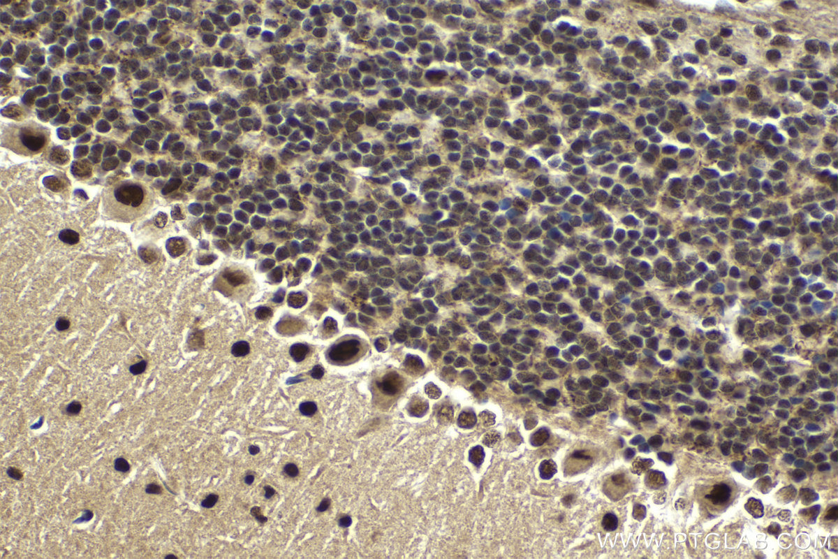 IHC staining of mouse cerebellum using 11609-1-AP