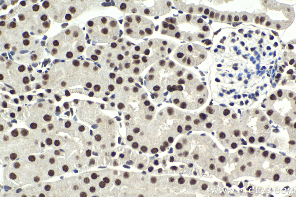 IHC staining of mouse kidney using 11609-1-AP