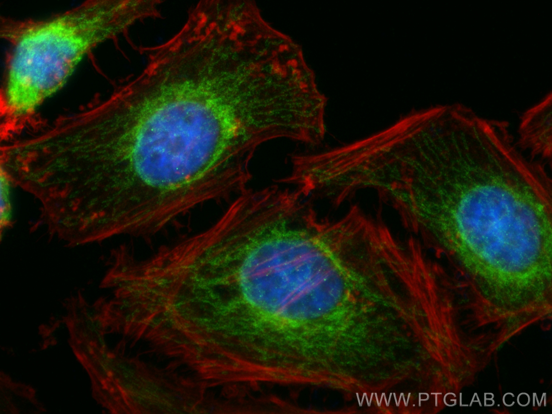 IF Staining of HeLa using 15184-1-AP