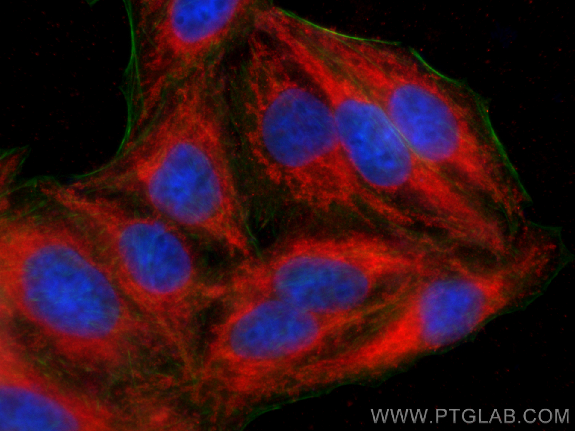 IF Staining of HepG2 using 15184-1-AP