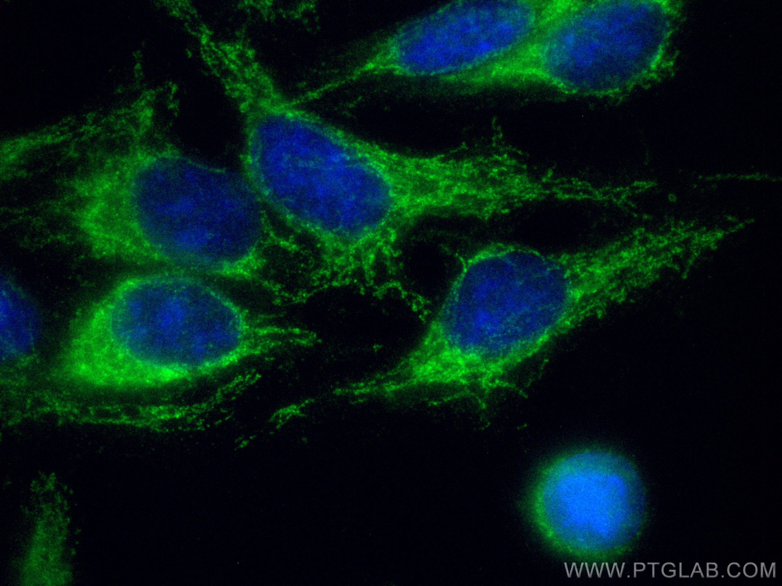 IF Staining of HepG2 using CL488-15184