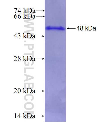 CPXM1 fusion protein Ag27344 SDS-PAGE