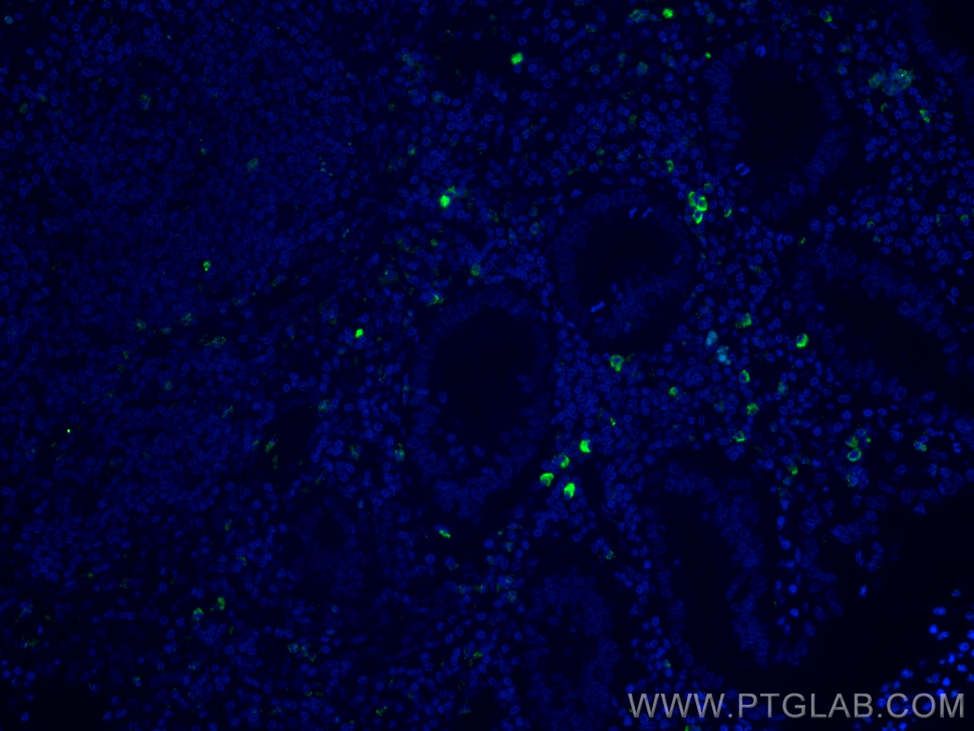 IF Staining of human appendicitis using CL488-68033