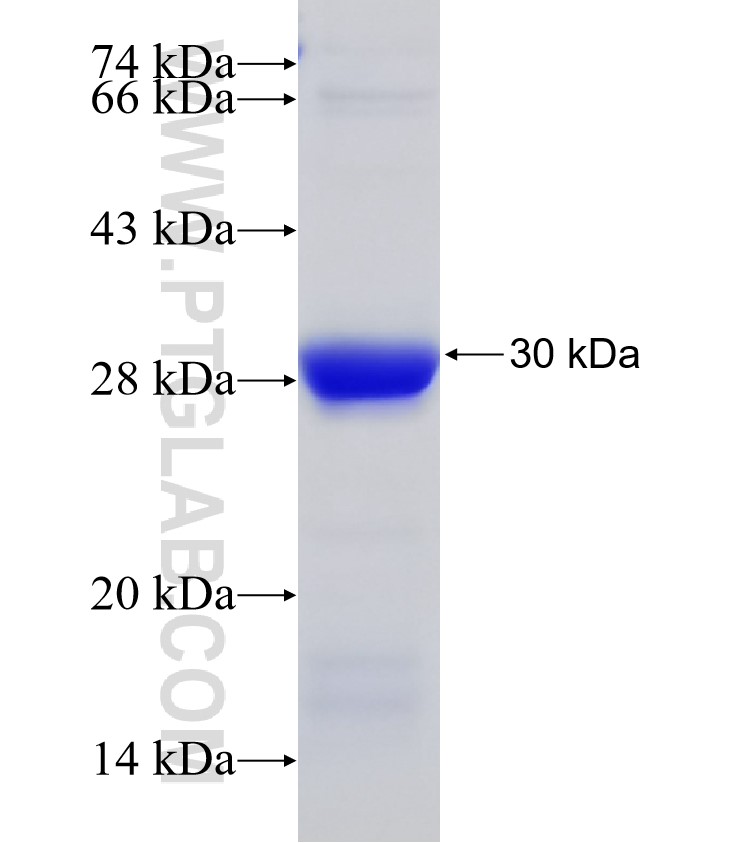 CR1 fusion protein Ag30268 SDS-PAGE