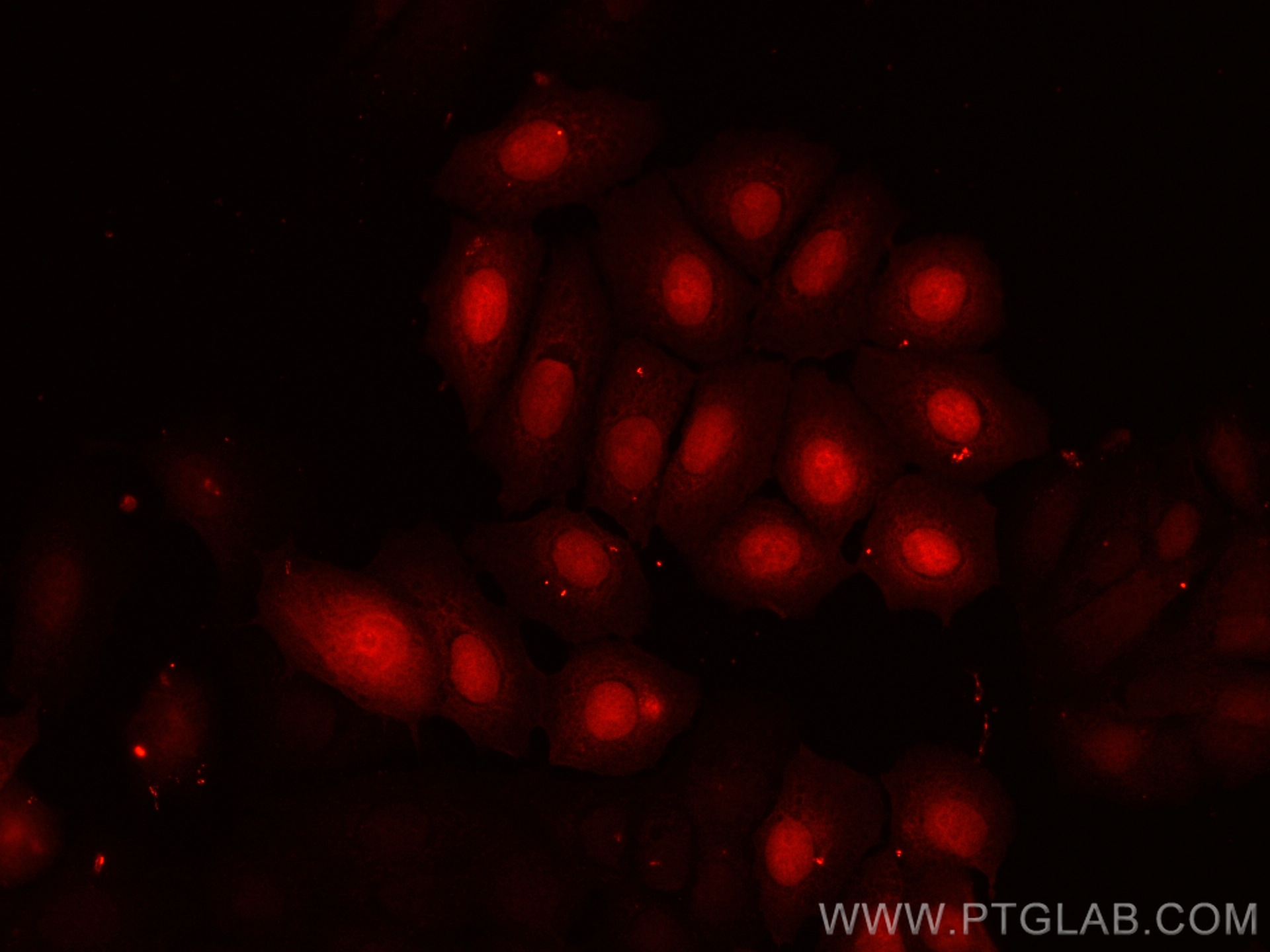 IF Staining of MCF-7 using CL594-10225