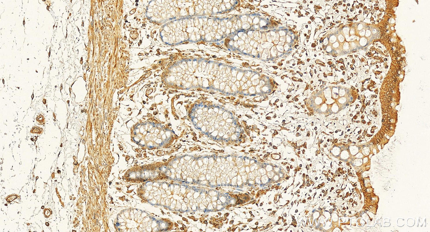 IHC staining of human colon using 66787-1-Ig (same clone as 66787-1-PBS)