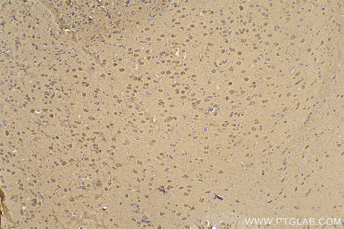 IHC staining of mouse brain using 15170-1-AP