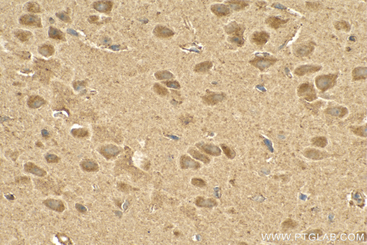 IHC staining of mouse brain using 15170-1-AP